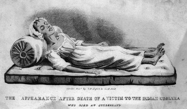 Een slachtoffer van choleria in het Engesle Sunderland in 1832.